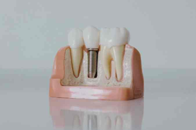 dental implants norwood village